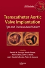 Image for Transcatheter aortic valve implantation: tips and tricks to avoid failure