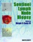 Image for Sentinel lymph node biopsy