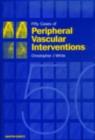 Image for Fifty cases of peripheral vascular interventions