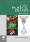 Image for An Atlas of Prostatic Diseases