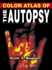 Image for Color Atlas of the Autopsy on CD-ROM