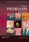 Image for An atlas of psoriasis