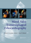 Image for Mitral valve transesophageal echocardiography