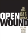 Image for Open Wound