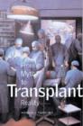 Image for Transplant