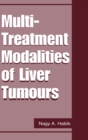 Image for Multi treatment modalities of liver tumours