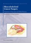 Image for Musculoskeletal cancer surgery: treatment of sarcomas and allied diseases