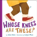 Image for Whose knees are these?