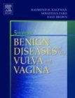 Image for Benign Diseases of the Vulva and Vagina