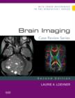 Image for Brain Imaging: Case Review Series