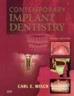 Image for Contemporary Implant Dentistry