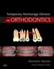 Image for Temporary Anchorage Devices in Orthodontics