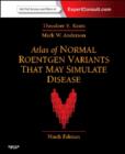 Image for Atlas of normal roentgen variants that may simulate disease