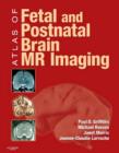 Image for Atlas of fetal and postnatal brain MR