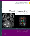 Image for Brain imaging