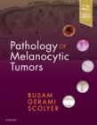 Image for Pathology of melanocytic tumors