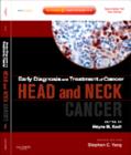Image for Head and neck cancer