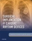 Image for Surgical Implantation of Cardiac Rhythm Devices