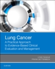 Image for Lung cancer  : a practical approach to evidence-based clinical evaluation and management