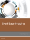 Image for Skull base imaging