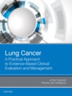 Image for Lung cancer: a practical approach to evidence-based clinical evaluation and management