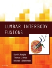 Image for Lumbar interbody fusions