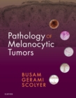 Image for Pathology of melanocytic tumors