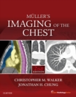 Image for Muller&#39;s Imaging of the Chest E-Book: Expert Radiology Series