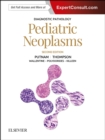 Image for Pediatric neoplasms