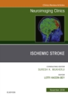 Image for Ischemic stroke