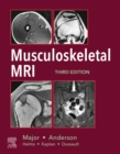 Image for Musculoskeletal MRI