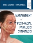 Image for Management of Post-Facial Paralysis Synkinesis