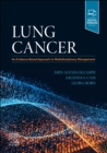 Image for Lung cancer  : an evidence-based approach to multidisciplinary management