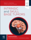 Image for Intrinsic and Skull Base Tumors - E-Book: a case-by-case management comparison