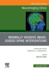 Image for Spine intervention : 29-4