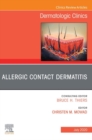Image for Allergic Contact Dermatitis