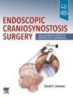 Image for Endoscopic craniosynostosis surgery