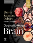 Image for Diagnostic Imaging: Brain