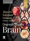 Image for Diagnostic Imaging. Brain