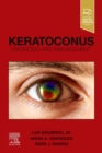 Image for Keratoconus  : diagnosis and management