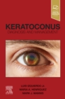 Image for Keratoconus,E-Book: Diagnosis and Management