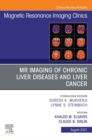 Image for MR Imaging of Chronic Liver Diseases and Liver Cancer