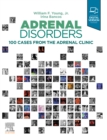 Image for Adrenal disorders: cases from the adrenal clinic