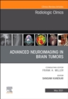 Image for Advanced neuroimaging in brain tumors : Volume 59-3