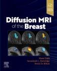 Image for Diffusion MRI of the Breast