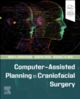 Image for Computer-Assisted Planning in Craniofacial Surgery