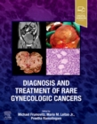 Image for Diagnosis and Treatment of Rare Gynecologic Cancers