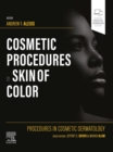 Image for Cosmetic procedures in skin of color