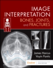 Image for Image interpretation  : bones, joints, and fractures