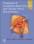 Image for Treatment of Acetabular Bone Loss and Chronic Pelvic Discontinuity